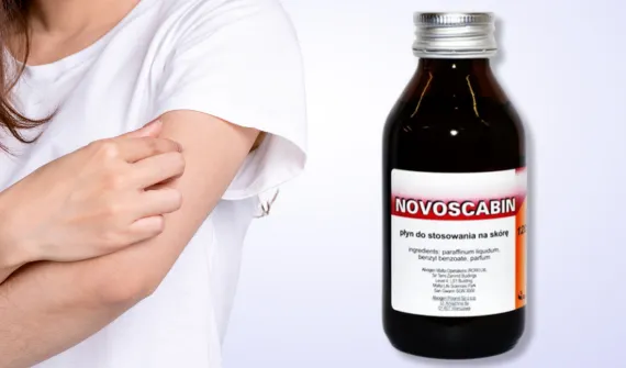 Świerzb – przyczyny zarażenia, objawy i leczenie